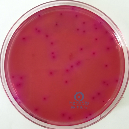 弗氏柠檬酸杆菌  紫红色菌落，可有胆盐沉淀环