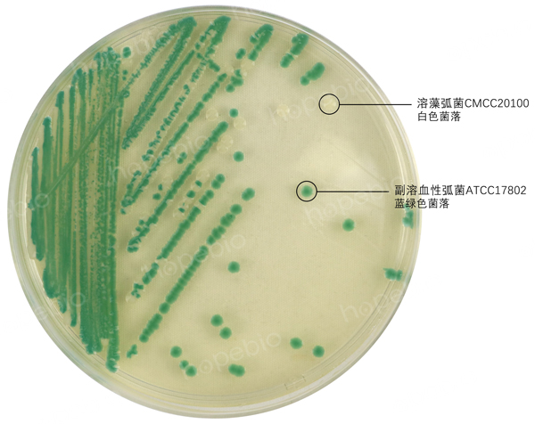 副溶血性弧菌在弧菌显色培养基上生长特征