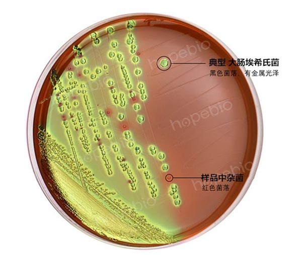 EMB培养不同菌株的试验结果（菌落黑色且有金属光泽的为大肠埃希氏菌）