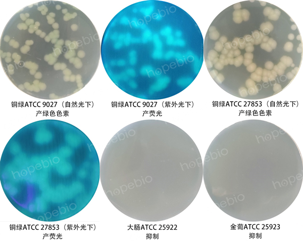 图1假单胞CFC选择性培养基的微生物质控结果