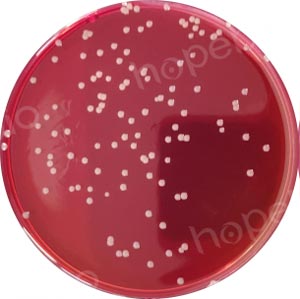 三株伯克霍尔德菌在含多粘菌素B、庆大霉素的BCSA琼脂平板上的菌落特征/